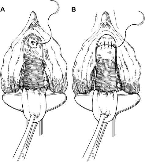 female urethra insertion porn